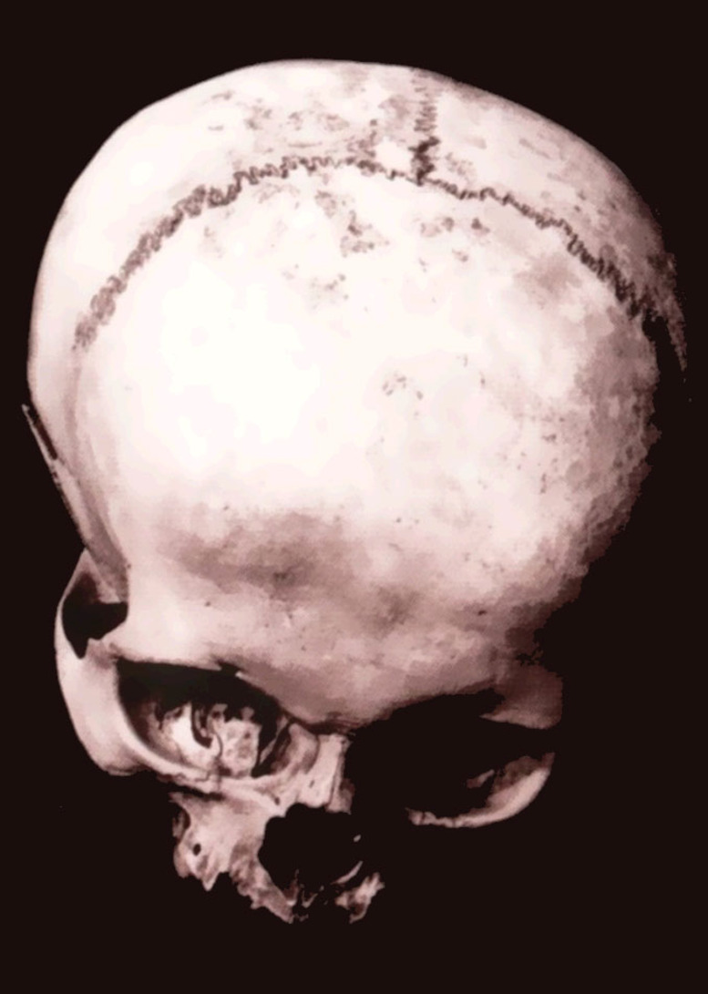 a gloomy skull